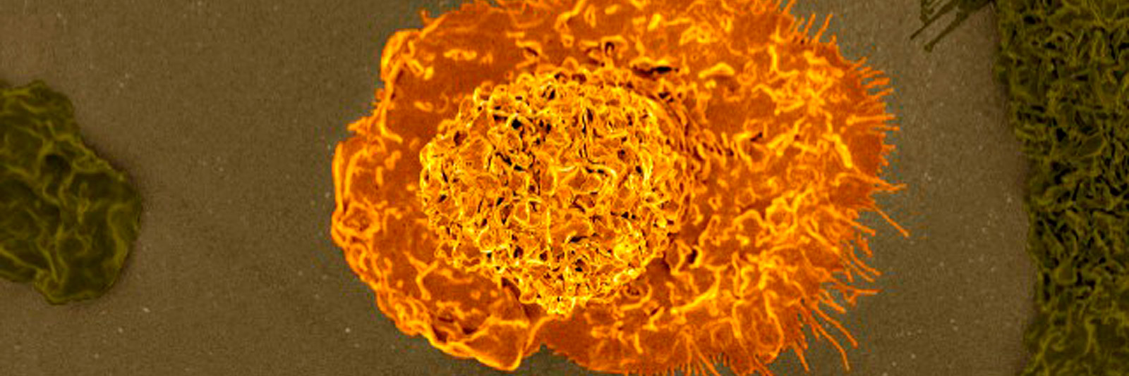 Macrophage | DCA Immunity